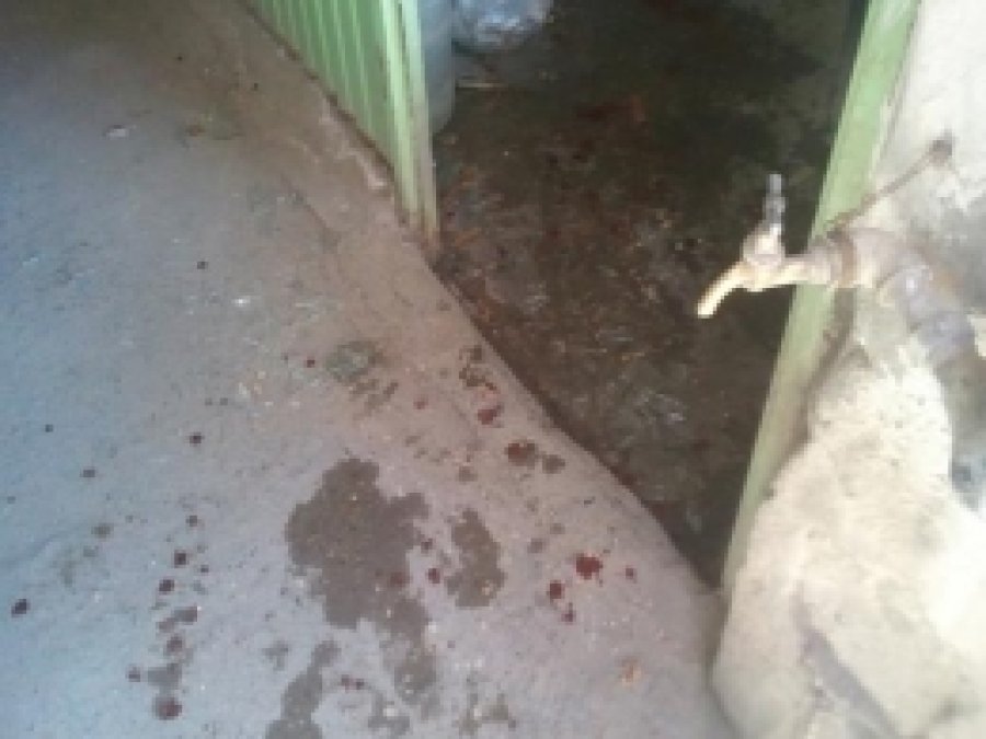 Viranşehir'de Kavga: 2 Yaralı