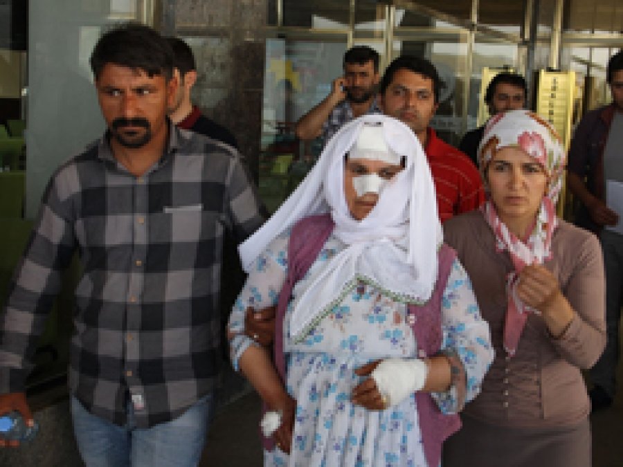 Van'da başıboş köpek 8 kişiyi yaraladı