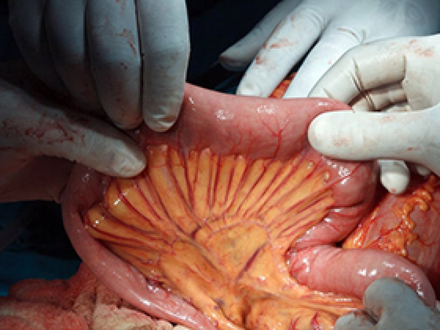 İnsan vücudunda yeni bir organ keşfedildi