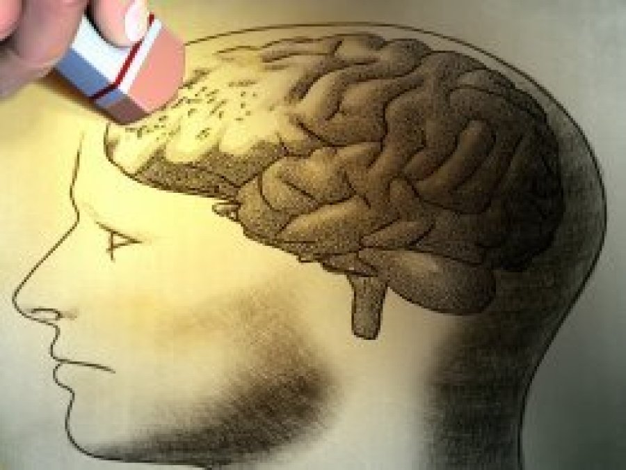 Alzheimer hastalarına umut ışığı mı doğuyor?