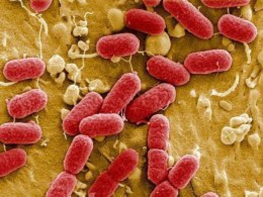 Antibiyotik direncine neden olan bakterinin gen transferi engellendi  