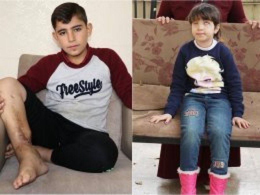 Minik bedenlerinde savaşın derin izlerini taşıyorlar
