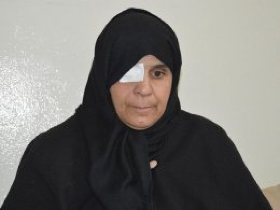 Suriyeli kadın ikinci gözünü de kaybetmek istemiyor