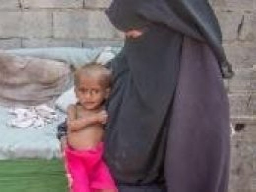 'Li Yemenê dibe ku 85 hezar zarok ji bîrçînan û nexweşîyan miribin'