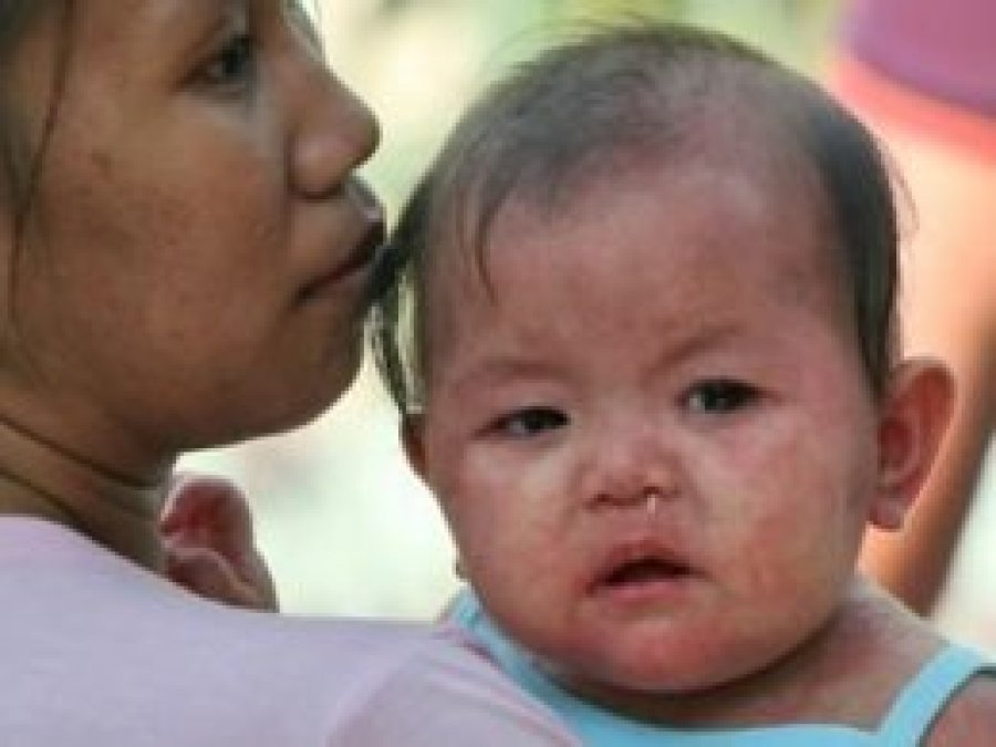 Filipinler'de kızamık salgını: 203 ölü