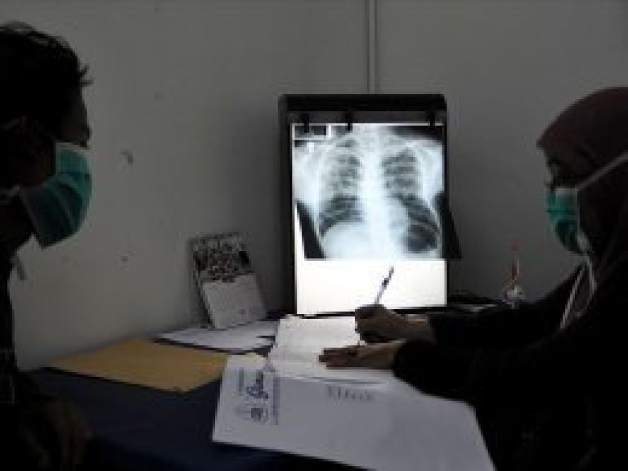 Dünyada her gün yaklaşık 4 bin 500 kişi veremden ölüyor