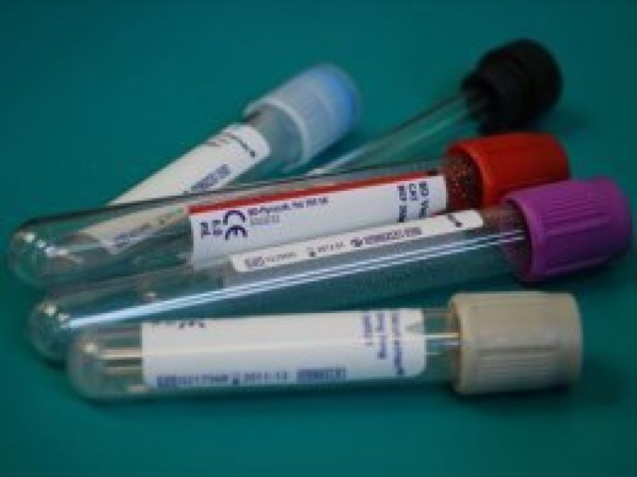 Hepatit virüsüne sahip her 10 kişiden 9'u hastalığından habersiz