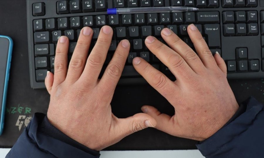 Kargo paketlerini 12 parmağıyla teslim alıyor